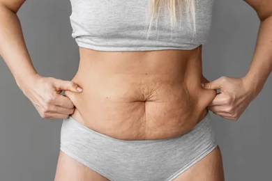 Can Diabetic Patients Have Tummy Tuck?