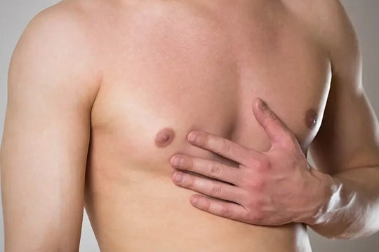 Gerçek Jinekomasti ve Yalancı Jinekomasti Farkı Nedir?