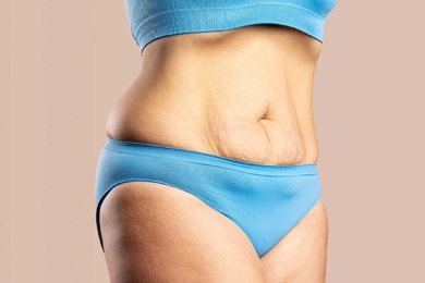 Is Tummy Tuck Surgery Painful? A Comprehensive Insight