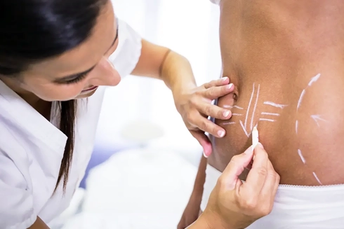 Karın Germe İçin Hangi Doktora, Bölüme Gidilir?