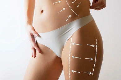 Neues Zeitalter im Body Shaping: VASER Liposuktion