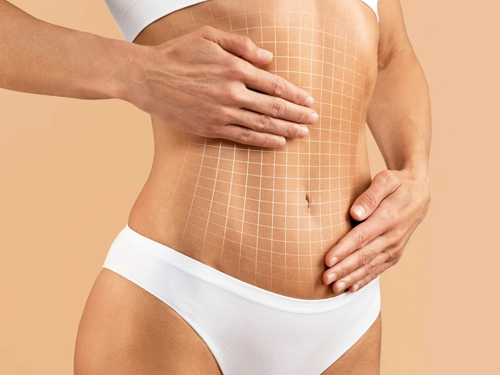 Karın Germe Ameliyatı Fiyatları 2026