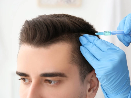 Platelet Rich Plasma (PRP) For Hair Loss